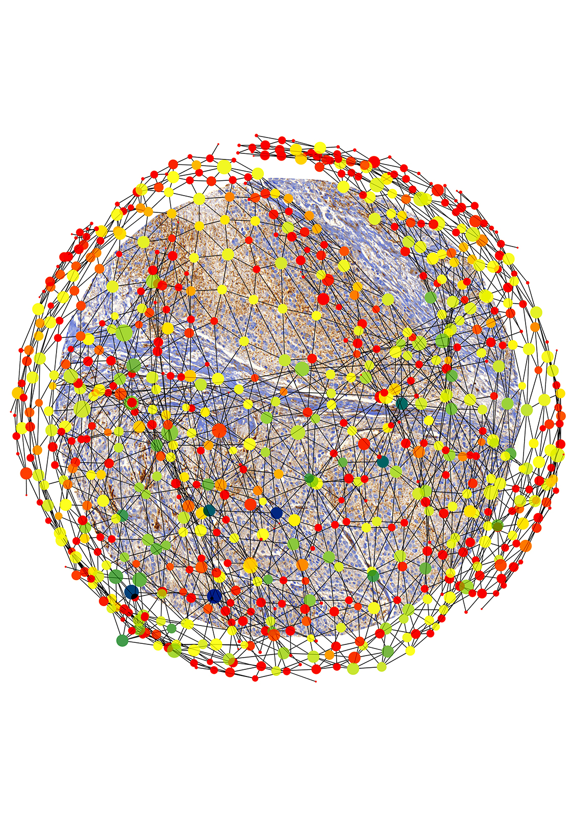 El análisis matemático de imágenes tumorales ayuda a entender qué hace que un cáncer pueda ser más o menos agresivo