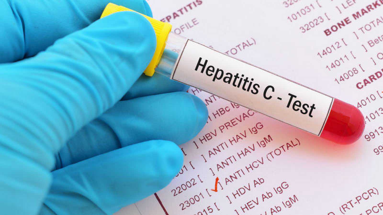 España, en la senda de eliminar la hepatitis C seis años antes del horizonte 2030 fijado por la OMS