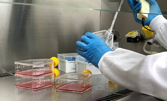 El CIBERER Biobank pone en marcha un servicio de detección de SARS-CoV-2 para muestras de enfermedades raras