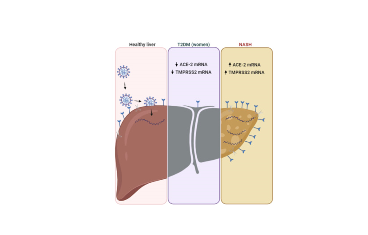 Los pacientes con obesidad e hígado graso con inflamación presentan un mayor riesgo tras infectarse con COVID-19