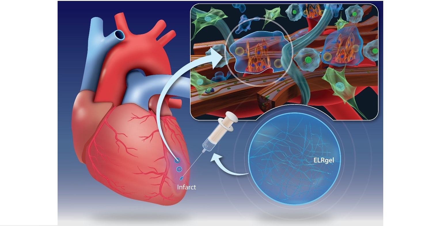 La inyección de un hidrogel puede promover la curación del músculo cardíaco después de un infarto