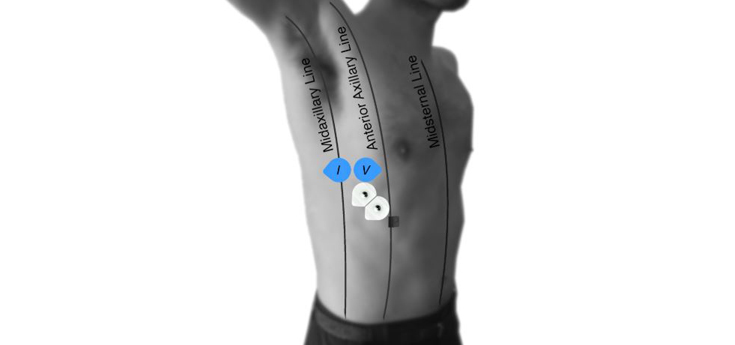 Desarrollan un método no invasivo para evaluar enfermedades pulmonares