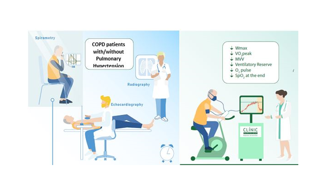 La presencia de Hipertensión Pulmonar reduce la tolerancia al esfuerzo en los pacientes con EPOC
