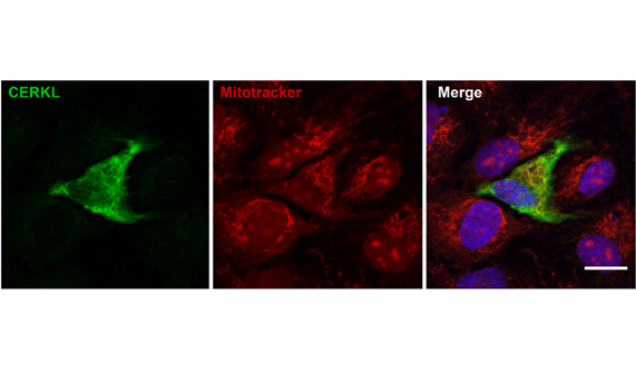 La sobreexpresión del gen causante de la retinosis pigmentaria ‘CERKL’ protege a las mitocondrias de la retina del estrés oxidativo