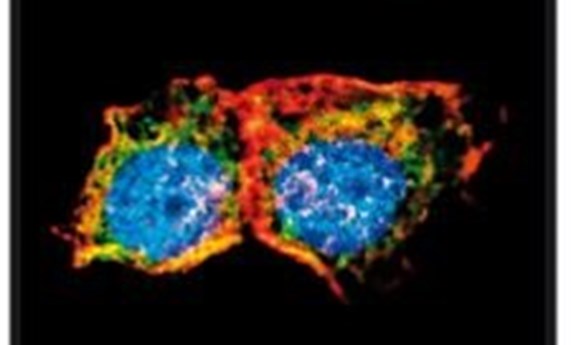 Describen la proteína Espinofilina como un supresor tumoral multifuncional Describen la proteína Espinofilina como un supresor tumoral multifuncional