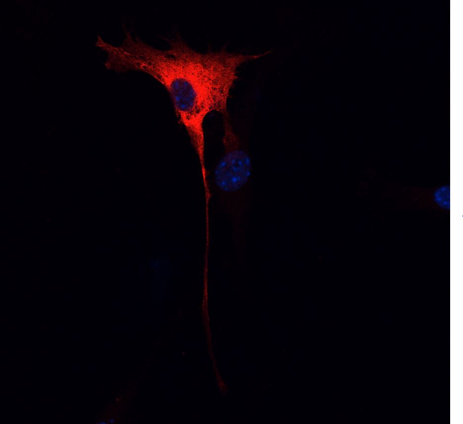 Descubierta una proteína que afecta a la eficacia de fármacos dirigidos al gen KRAS