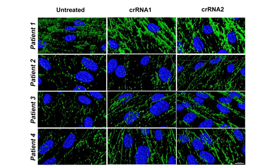 La edición genética por CRISPR/Cas9 abre las puertas a una nueva estrategia terapéutica para las distrofias musculares congénitas por déficit de colágeno VI