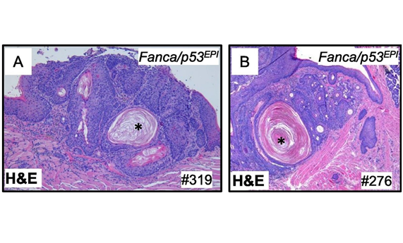 Publican el primer modelo de ratón de carcinomas escamosos de cabeza y cuello en anemia de Fanconi