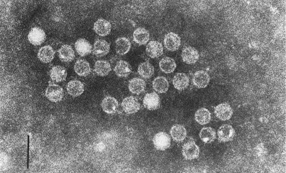 Primeras detecciones en España de un tipo de enterovirus poco conocido ligado a enfermedad respiratoria y neurológica Primeras detecciones en España de un tipo de enterovirus poco conocido ligado a enfermedad respiratoria y neurológica