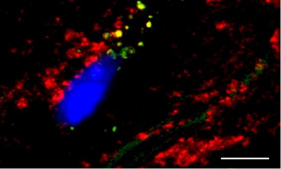 Una inmunoterapia experimental logra revertir el daño energético del corazón causado por el colesterol Una inmunoterapia experimental logra revertir el daño energético del corazón causado por el colesterol