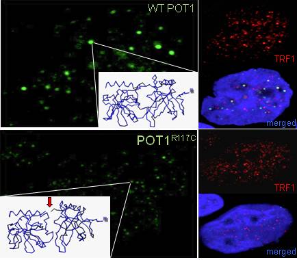 Identifican un gen responsable de las formas familiares de angiosarcoma cardiaco