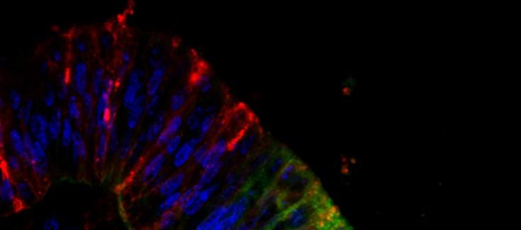Caracterizan una nueva función para Cdon, un gen implicado en malformaciones congénitas del desarrollo