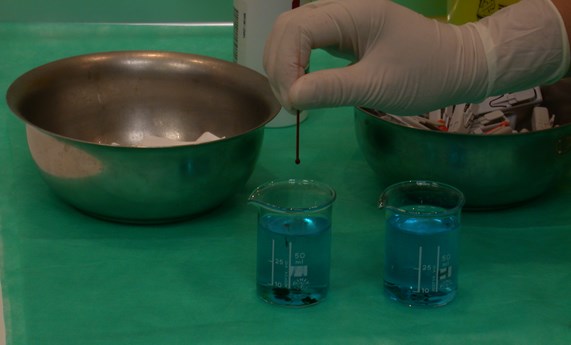 Análisis de sangre facilitarán la idoneidad en los tratamientos psiquiátricos Análisis de sangre facilitarán la idoneidad en los tratamientos psiquiátricos