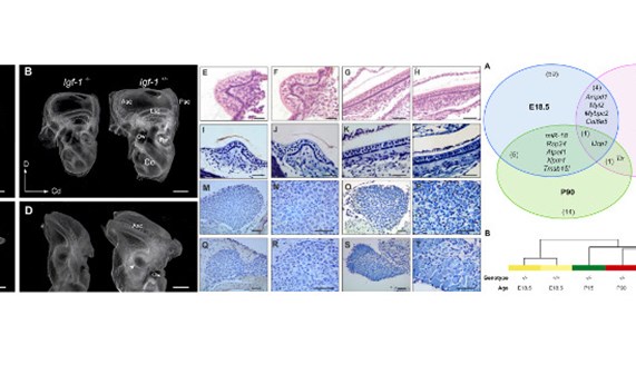 La deficiencia en IGF-1 altera los niveles de expresión de microRNAs y afecta a la incorporación postnatal de neuronas vestibulares