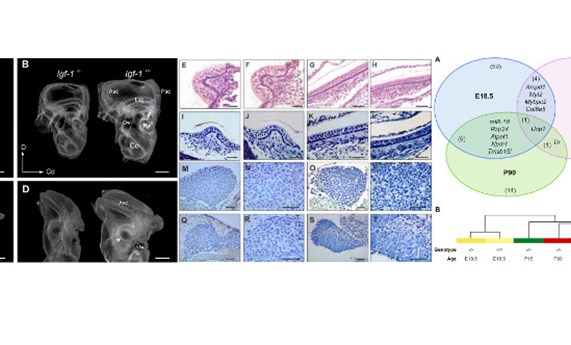 La deficiencia en IGF-1 altera los niveles de expresión de microRNAs y afecta a la incorporación postnatal de neuronas vestibulares La deficiencia en IGF-1 altera los niveles de expresión de microRNAs y afecta a la incorporación postnatal de neuronas vestibulares
