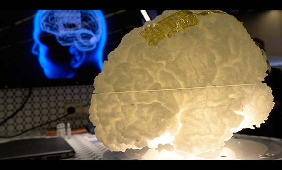 Crean unos sensores de grafeno que permiten detectar la actividad eléctrica del cerebro Crean unos sensores de grafeno que permiten detectar la actividad eléctrica del cerebro
