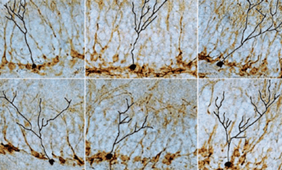Describen una estrategia terapéutica para la depresión basada en técnicas moleculares que silencian el transportador de serotonina Describen una estrategia terapéutica para la depresión basada en técnicas moleculares que silencian el transportador de serotonina