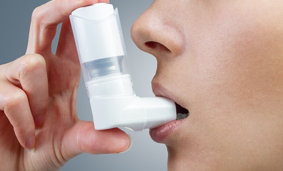 Mejorar el conocimiento de los mecanismos fisiopatológicos implicados en los diferentes tipos de asma, un reto para el CIBERES Mejorar el conocimiento de los mecanismos fisiopatológicos implicados en los diferentes tipos de asma, un reto para el CIBERES