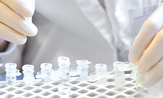 Convocatoria del CNAG para la secuenciación completa del exoma de muestras de enfermedades raras