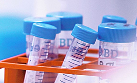 Investigadores del CIBERER participan en 12 de los proyectos de secuenciación completa del exoma y análisis bioinformático que financiará el CNAG