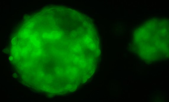 Un adenovirus oncolítico presenta sinergias con dos fármacos en el tratamiento de tumores pancreáticos en una prueba de concepto