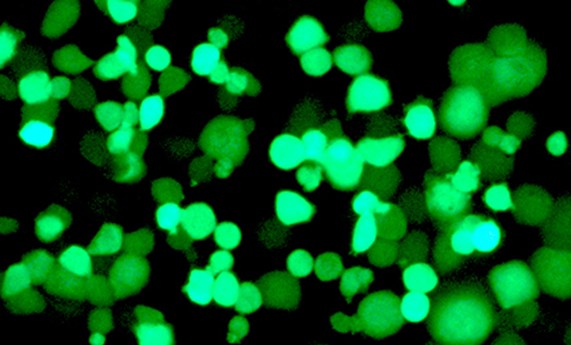 Crean virus que atacan de forma selectiva a las células tumorales Crean virus que atacan de forma selectiva a las células tumorales