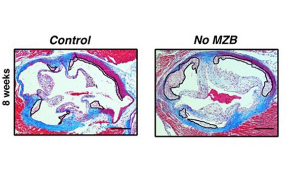 Descubren un papel protector ‘inesperado’ de un subtipo de células del sistema inmune frente a la aterosclerosis Descubren un papel protector ‘inesperado’ de un subtipo de células del sistema inmune frente a la aterosclerosis