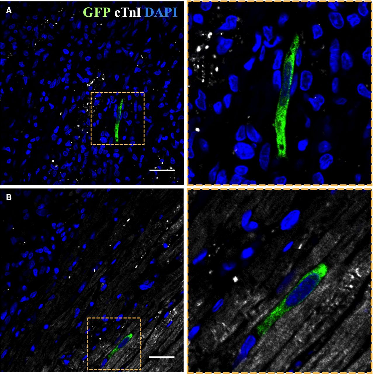 Nueva terapia celular para infarto de miocardio en modelos animales