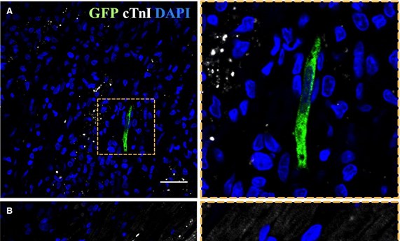Nueva terapia celular para infarto de miocardio en modelos animales Nueva terapia celular para infarto de miocardio en modelos animales