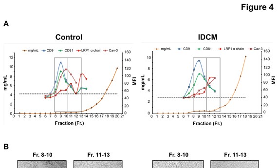 Hallan un nuevo biomarcador para los pacientes con miocardiopatía dilatada idiopática Hallan un nuevo biomarcador para los pacientes con miocardiopatía dilatada idiopática