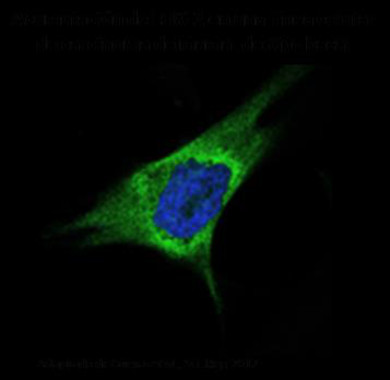Nuevo mecanismo de actuación de la proteína LOXL2 en la progresión tumoral